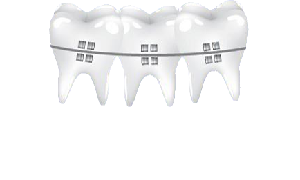 alkire orthodontics